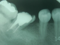 endo10-2