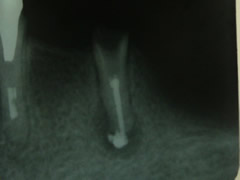 endo13-2