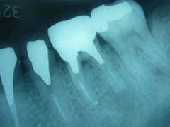 endo14-1