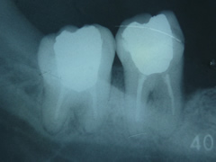 endo16-1