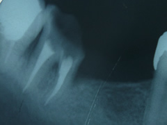 endo16-2
