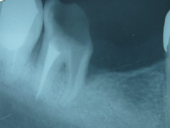 endo16-3