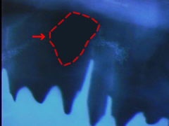 endo18-1