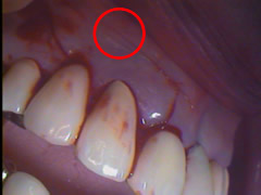 endo18-2