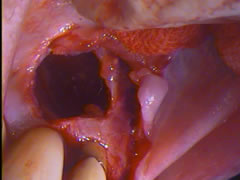endo18-3