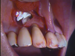 endo18-7