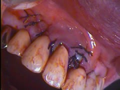 endo18-8