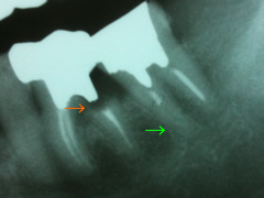 endo19-1