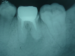 endo9-1